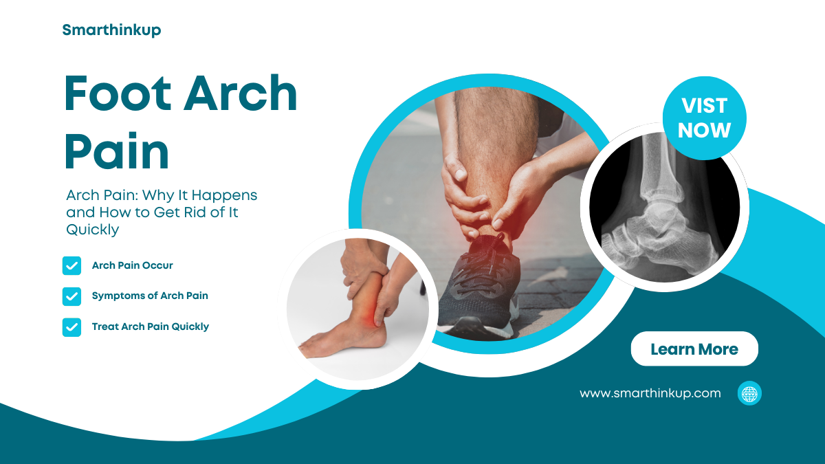 Arch pain in foot caused by plantar fasciitis with heel inflammation illustration